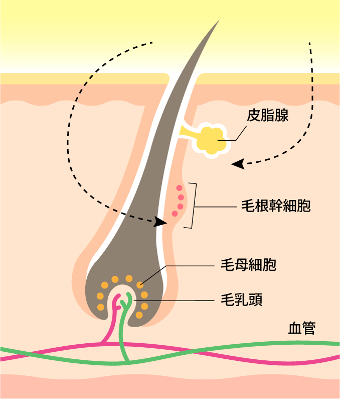 OPT脱毛の図